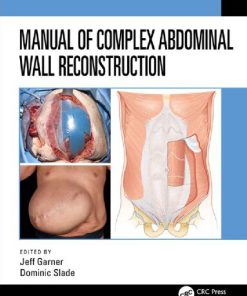 Manual of Complex Abdominal Wall Reconstruction 1st Edition Jeff Garner Editor Dominic Slade Editor
